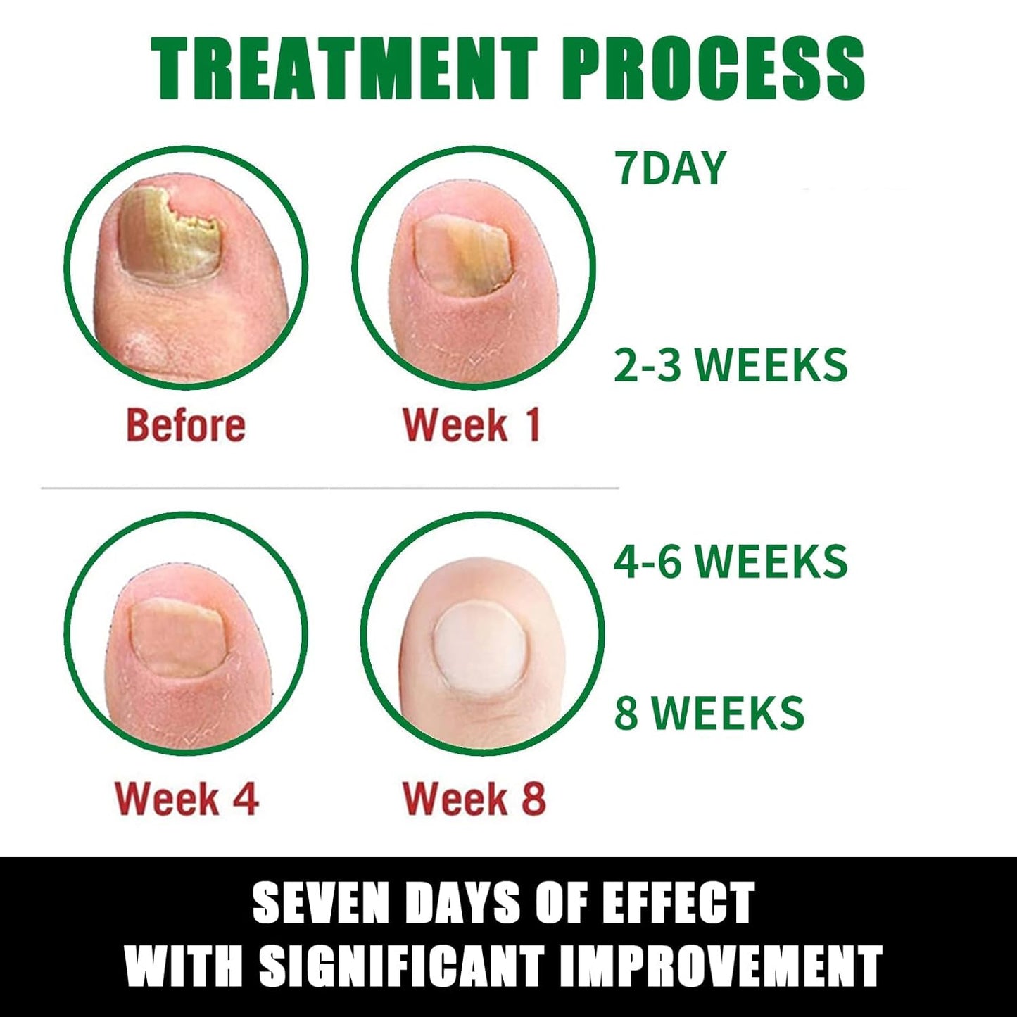 7 Day Nail Fungus Treatment