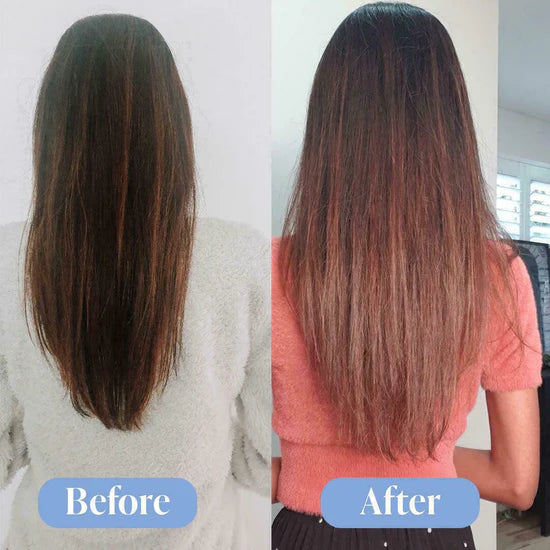 Anti-Hairfall Shampoo