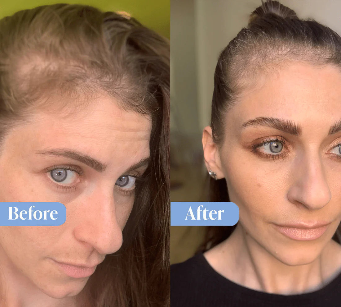 Anti-Hairfall Shampoo