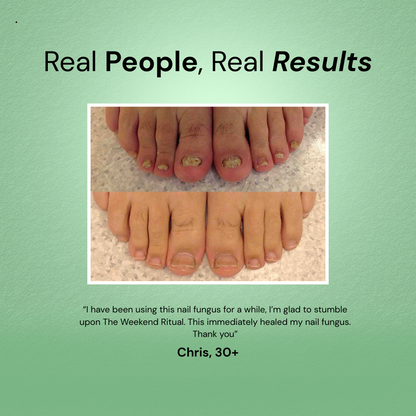 RootClarity™ Nail Serum